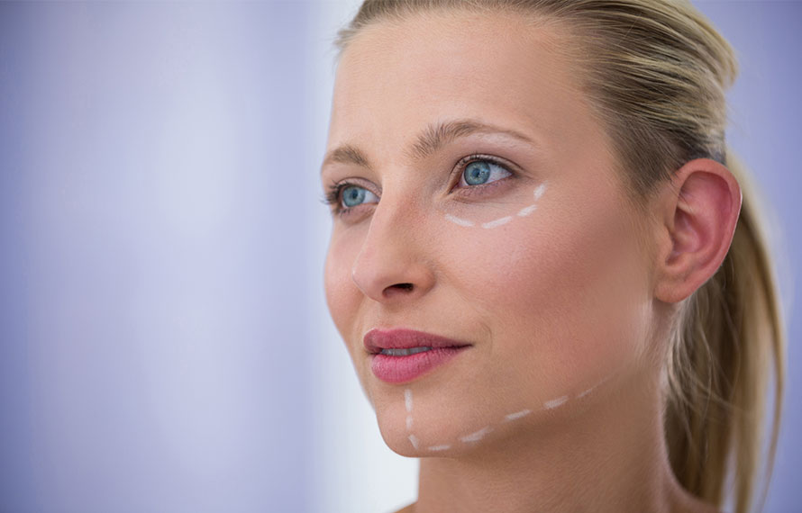Full facelift visual from Eteris Clinic
