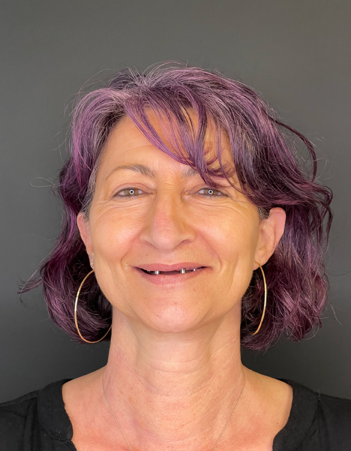 Before image for Smile rehabilitation example at Brianza Dent