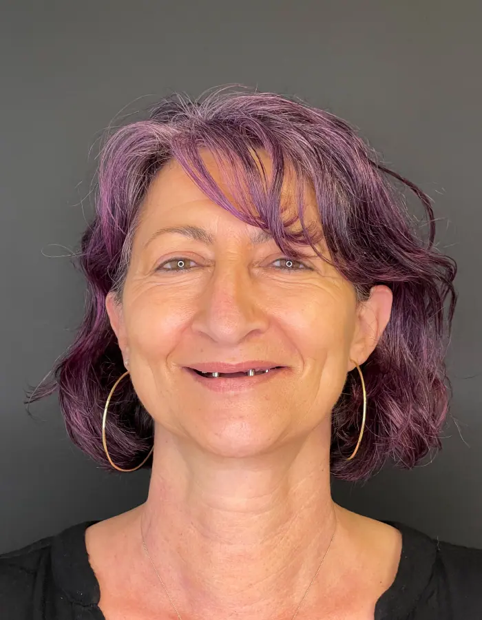 Before image for Smile rehabilitation example at Brianza Dent